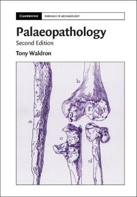 Cambridge Manuals in Archaeology #: Palaeopathology  (2nd Edition)