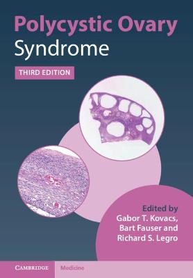 Polycystic Ovary Syndrome  (3rd Revised Edition)