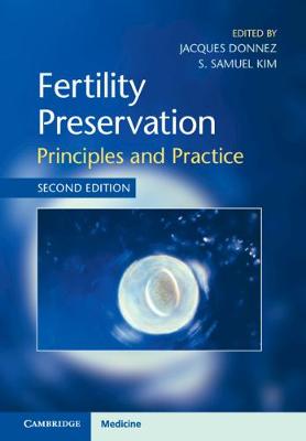 Fertility Preservation  (2nd Edition)