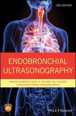Endobronchial Ultrasonography (2nd Edition)