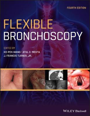 Flexible Bronchoscopy (4th Edition)