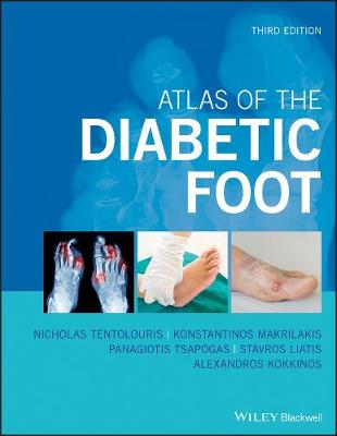 Atlas of the Diabetic Foot (3rd Edition)