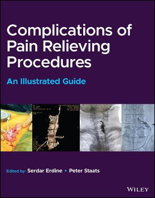 Complications of Pain-Relieving Procedures